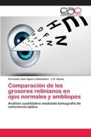Comparación de los grosores retinianos en ojos normales y ambliopes 6202117680 Book Cover