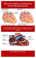 BRADYCARDIA CONDITION (LOW HEART RATE): A COMPREHENSIVE OUTLINE ON HOW TO DIAGNOSE, TREAT AND CARE FOR BRADYCARDIA CONDITION (LOW HEART RATE) IN HUMANS B08Z9VZV8S Book Cover