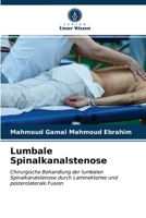 Lumbale Spinalkanalstenose 6203544965 Book Cover