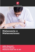 Malassezia e Malassezioses 6205729806 Book Cover