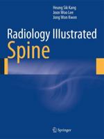 Radiology Illustrated: Spine 3642356281 Book Cover