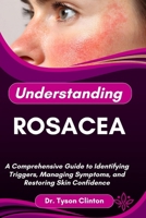 UNDERSTANDING ROSACEA: A Comprehensive Guide to Identifying Triggers, Managing Symptoms, and Restoring Skin Confidence B0FRNMYT3T Book Cover