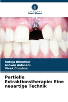 Partielle Extraktionstherapie: Eine neuartige Technik (German Edition) 6207972422 Book Cover