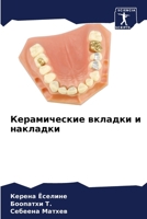 Керамические вкладки и н 6206974871 Book Cover
