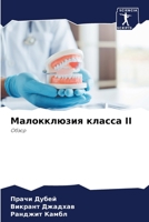 Малокклюзия класса II: Обзор 6206007448 Book Cover