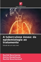 A tuberculose óssea: da epidemiologia ao tratamento (Portuguese Edition) 6630055985 Book Cover