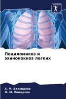 Пециломикоз и эхинококкоз легких 6206356329 Book Cover