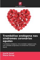 Trombólise endógena nas síndromes coronárias agudas (Portuguese Edition) 6208112818 Book Cover