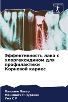 Эффективность лака с хлоргексидином для профилактики Корневой кариес 6203770388 Book Cover