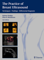 The Practice of Breast Ultrasound: Techniques, Findings, Differential Diagnosis 0865778981 Book Cover