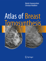 Atlas of Breast Tomosynthesis: Imaging Findings and Image-Guided Interventions 3319215655 Book Cover