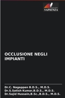 Occlusione Negli Impianti 6203948586 Book Cover