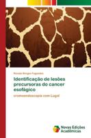 Identificação de lesões precursoras do cancer esofágico: cromoendoscopia com Lugol 6202174811 Book Cover
