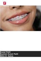 Redução interproximal do esmalte 6205614340 Book Cover