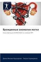 Врожденные аномалии матки: Классификация ESHRE/ESGE по снимкам МРТ 6202582812 Book Cover