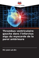 Thrombus ventriculaire gauche dans l'infarctus aigu du myocarde de la paroi antérieure 6136286815 Book Cover