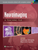 Neuroimaging: A Teaching File: A Teaching File 1451173288 Book Cover