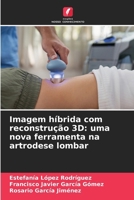 Imagem híbrida com reconstrução 3D: uma nova ferramenta na artrodese lombar (Portuguese Edition) 6209684335 Book Cover