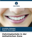 Zahnimplantate in der ästhetischen Zone 6207259734 Book Cover