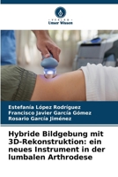 Hybride Bildgebung mit 3D-Rekonstruktion: ein neues Instrument in der lumbalen Arthrodese (German Edition) 6209674097 Book Cover