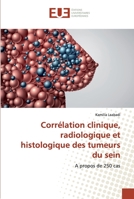 Corrélation clinique, radiologique et histologique des tumeurs du sein 6138455509 Book Cover