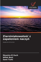 Ziarniniakowatosc z zapaleniem naczyn (Polish Edition) 6209330614 Book Cover