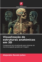 Visualização de estruturas anatómicas em 3D: Componente de visualização para sistemas de neuronavegação guiados por imagem (Portuguese Edition) B0CKKWDH4D Book Cover