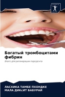 Богатый тромбоцитами фибрин: Благо для регенерации пародонта 6204054007 Book Cover