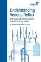 Understanding Venous Reflux the Cause of Varicose Veins and Venous Leg Ulcers (College of Phlebology) 1908586001 Book Cover