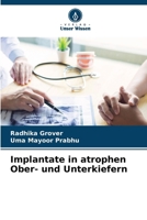 Implantate in atrophen Ober- und Unterkiefern (German Edition) 6208351278 Book Cover
