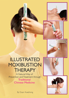 Illustrated Moxibustion Therapy: A Natural Way of Prevention and Treatment through Traditional Chinese Medicine 1602200378 Book Cover