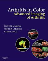 Arthritis in Color: Advanced Imaging of Arthritis 1416047220 Book Cover