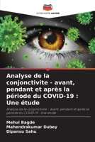 Analyse de la conjonctivite - avant, pendant et après la période du COVID-19: Une étude (French Edition) 6208140390 Book Cover