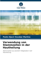 Verwendung von Stammzellen in der Hautheilung (German Edition) 6207742680 Book Cover