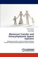 Blastocyst Transfer and Intracytoplasmic Sperm Injection: Blastocyst transfer vs Day 2 and Day 3 Embryo Transfer Following Intracytoplasmic Sperm Injection 3659122211 Book Cover