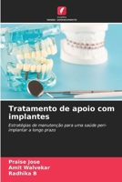 Tratamento de apoio com implantes (Portuguese Edition) 6209810101 Book Cover