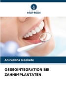 Osseointegration Bei Zahnimplantaten (German Edition) 6209860907 Book Cover