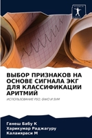 ВЫБОР ПРИЗНАКОВ НА ОСНОВЕ СИГНАЛА ЭКГ ДЛЯ &#10 620399474X Book Cover