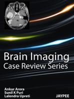 Brain Imaging: Case Review Series 9350253895 Book Cover