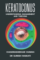 Keratoconus: Understanding, Managing, and Thriving, B0FKK19Z2X Book Cover