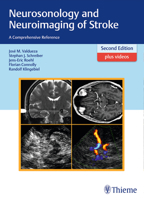 Neurosonology and Neuroimaging of Stroke: A Comprehensive Reference 3131418729 Book Cover