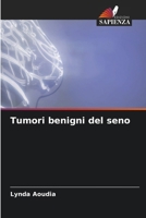 Tumori benigni del seno (Italian Edition) 6207945913 Book Cover