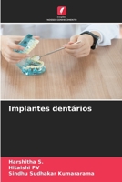 Implantes dentários (Portuguese Edition) 6630081749 Book Cover
