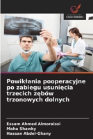 Powiklania pooperacyjne po zabiegu usuniecia trzecich zebów trzonowych dolnych (Polish Edition) 6208884586 Book Cover