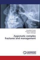 Zygomatic complex fractures and management 3659529672 Book Cover