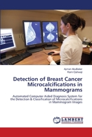 Detection of Breast Cancer Microcalcifications in Mammograms: Automated Computer Aided Diagnosis System for the Detection & Classification of Microcalcifications in Mammogram Images 3659132624 Book Cover