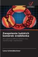 Zwapnienie ludzkich komórek sródblonka (Polish Edition) 620966606X Book Cover