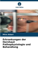 Erkrankungen der Hornhaut Pathophysiologie und Behandlung (German Edition) 6208906113 Book Cover