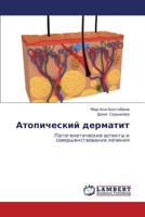Atopicheskiy Dermatit 3659348392 Book Cover