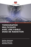Tomographie Multicoupe Avec Une Faible Dose de Radiation (French Edition) 6207516842 Book Cover